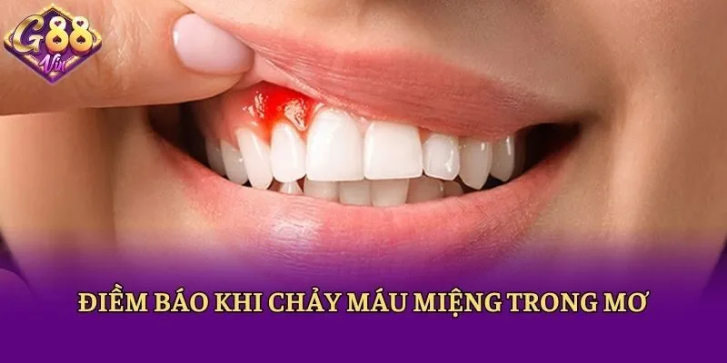 Điềm báo khi chảy máu miệng trong mơ